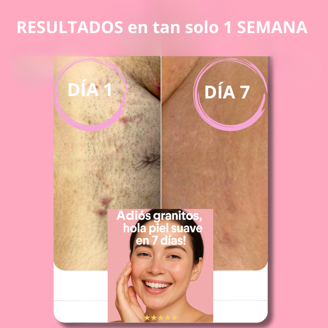 MiracleGlow - Depilación sin irritacion ni dolor
