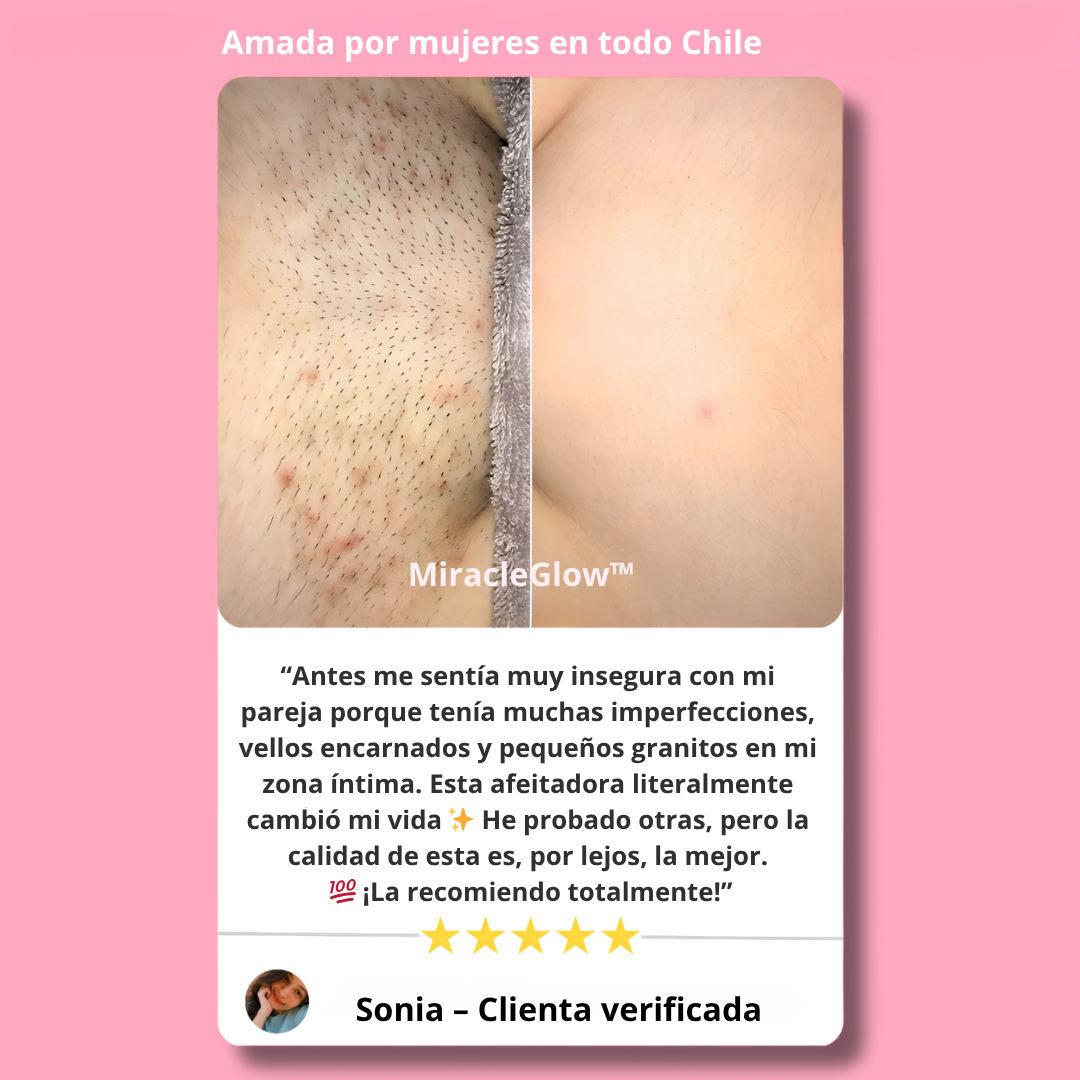 MiracleGlow - Depilación sin irritacion ni dolor