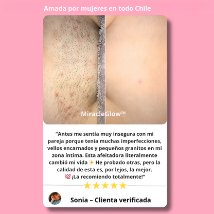 MiracleGlow - Depilación sin irritacion ni dolor